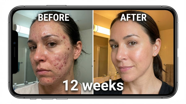 DermaPure content image